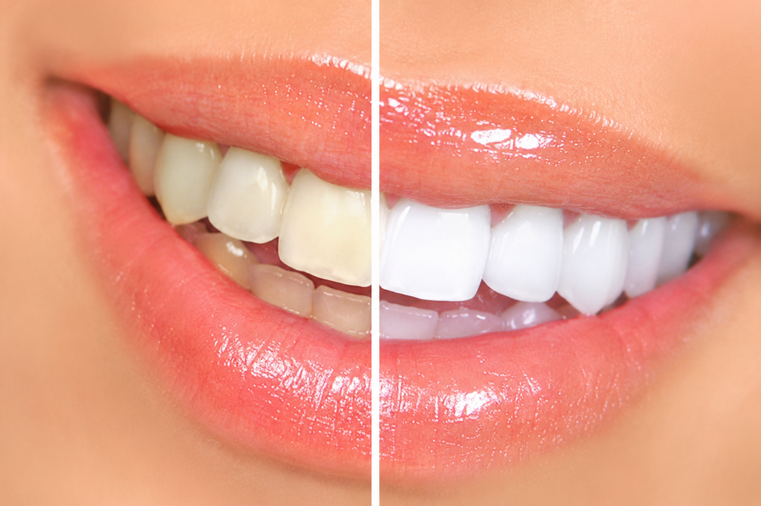 Estetica Dentale